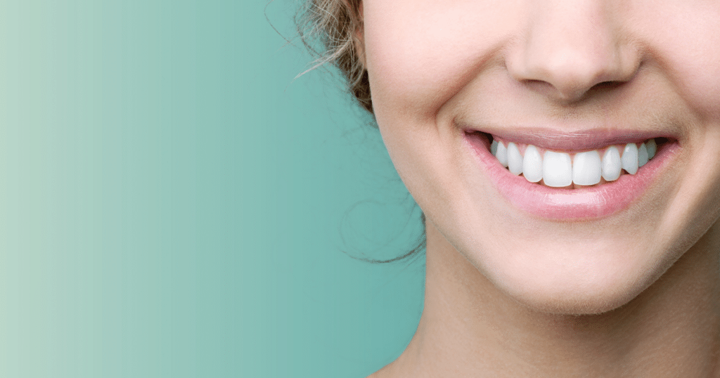 Zoomed in image of woman's white teeth.