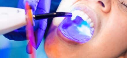 Woman receiving dental sealants