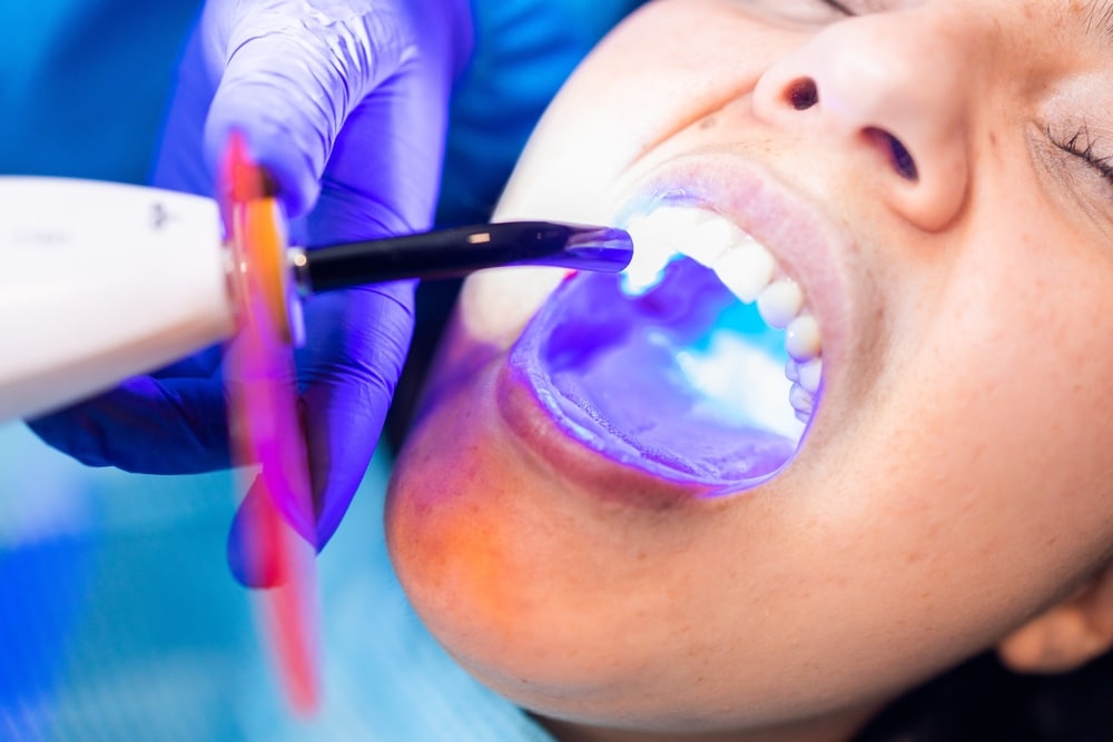 Woman receiving dental sealants