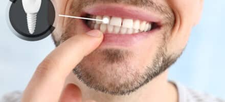 Man showing his teeth